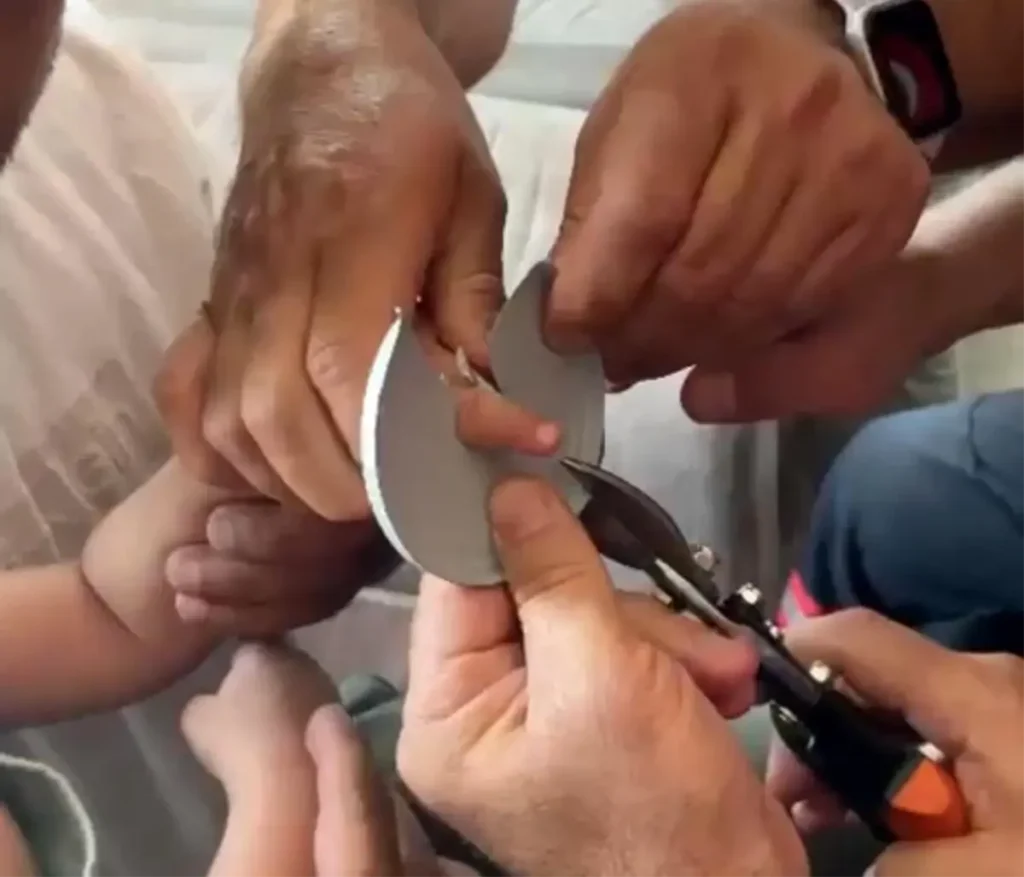 Batman’da Çocuğun Eli Metal Cisme Sıkıştı