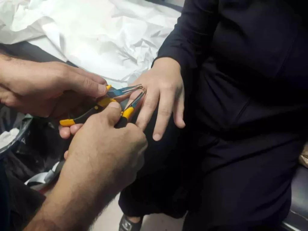 Batman’da Kadının Parmağına Sıkışan Yüzük İtfaiye Ekipleri Tarafından Çıkarıldı