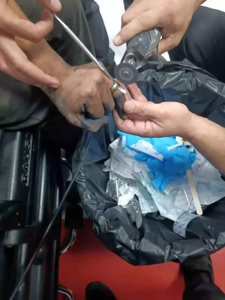 Batman’da Parmağında Sıkışan Yüzük Hastanede Çıkarıldı