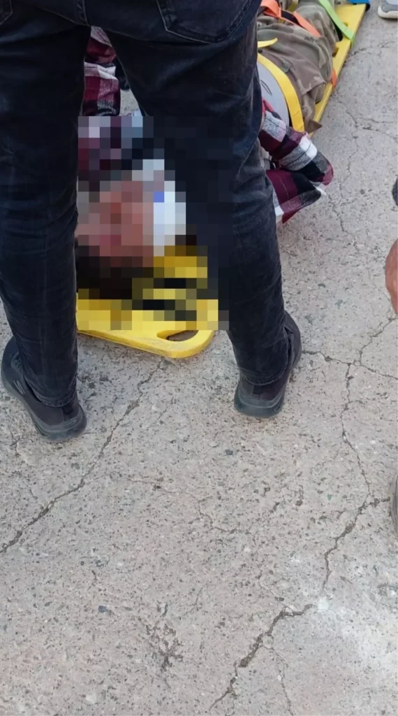 Batman’da Fidan Dikerken Kayalıklardan Düşen Adam Ağır Yaralandı